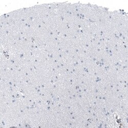 SP100 Antibody, Novus Biologicals:Antibodies:Primary Antibodies